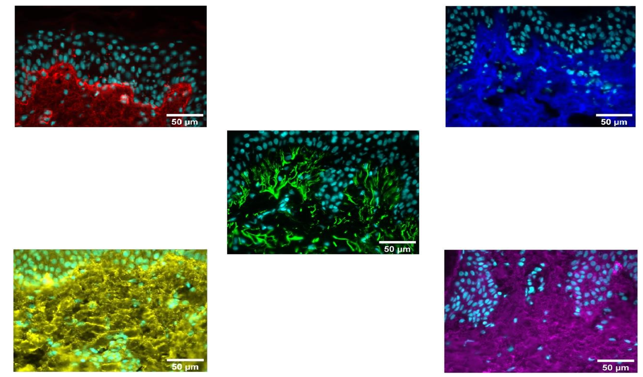 Linodermine ex vivo results