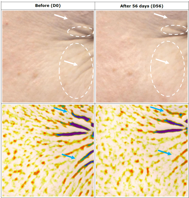 Clinical anti-aging improvement with Linodermine