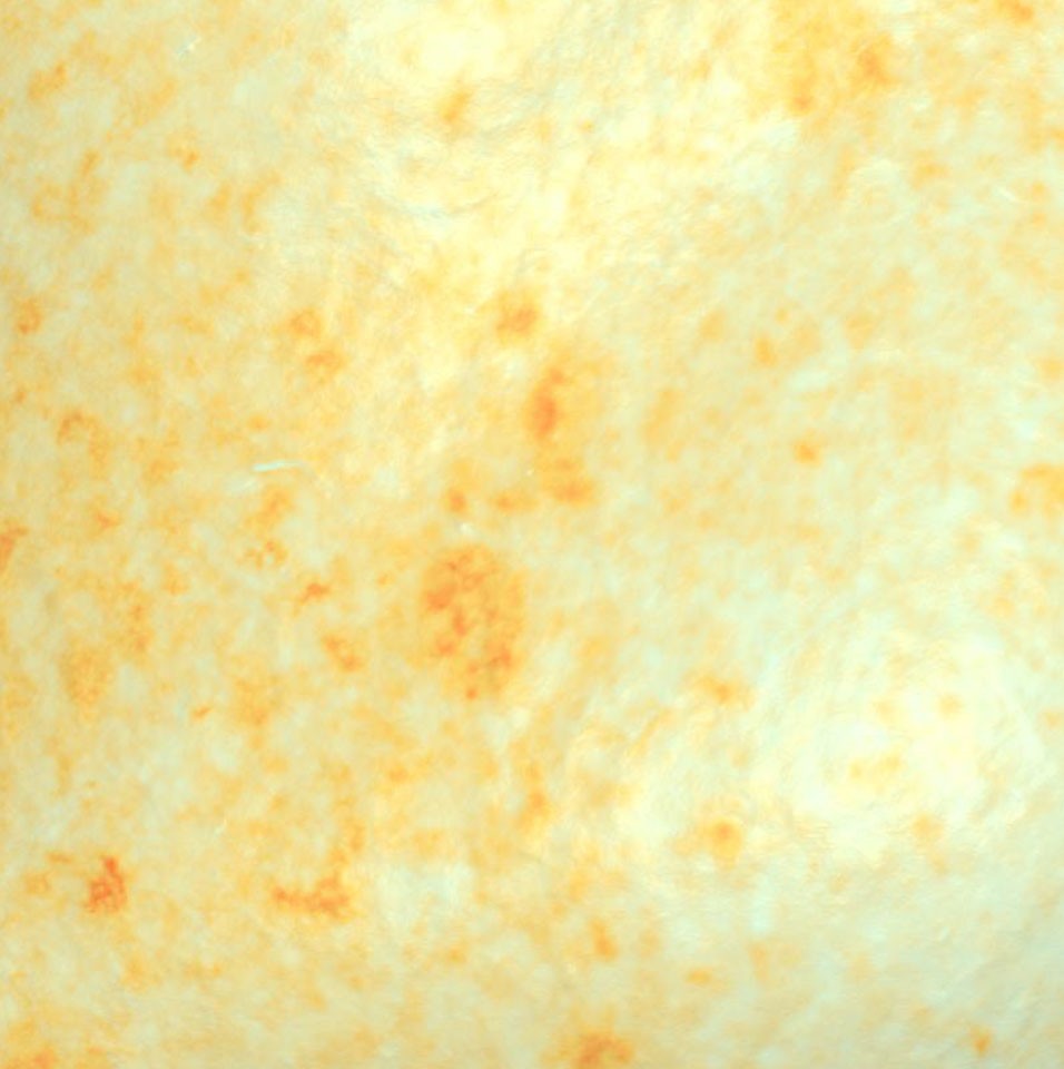 Skin before treatment, day 0