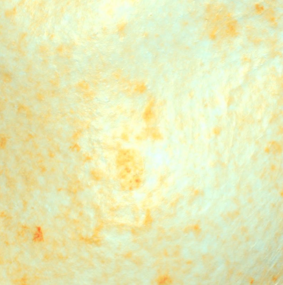 Lumidermine clinical result after 56 days